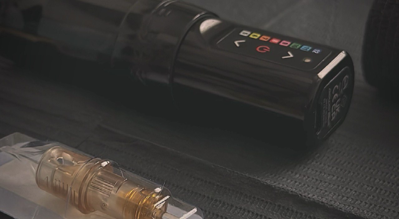 Microneedling